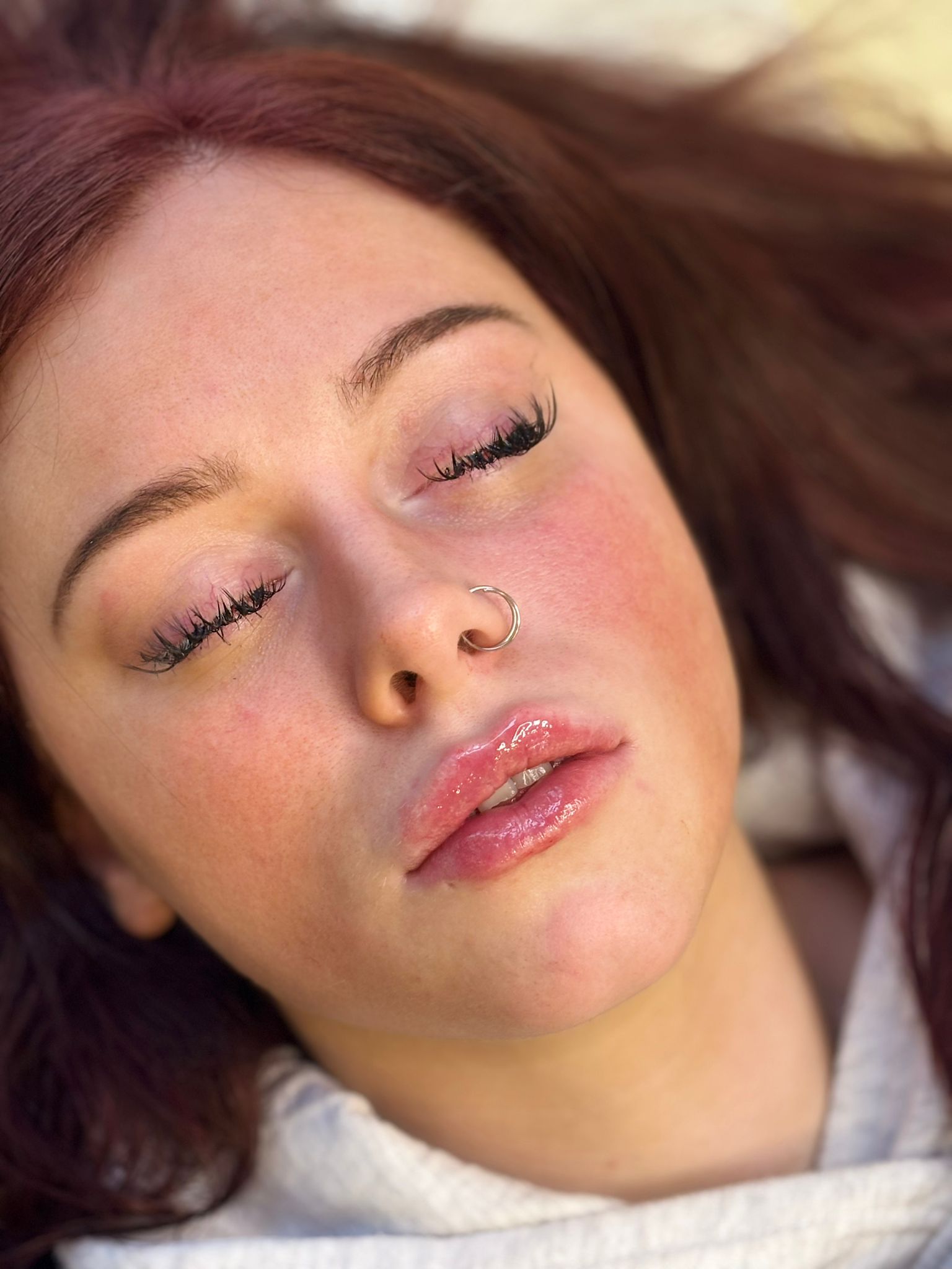 Anti-wrinkle treatments