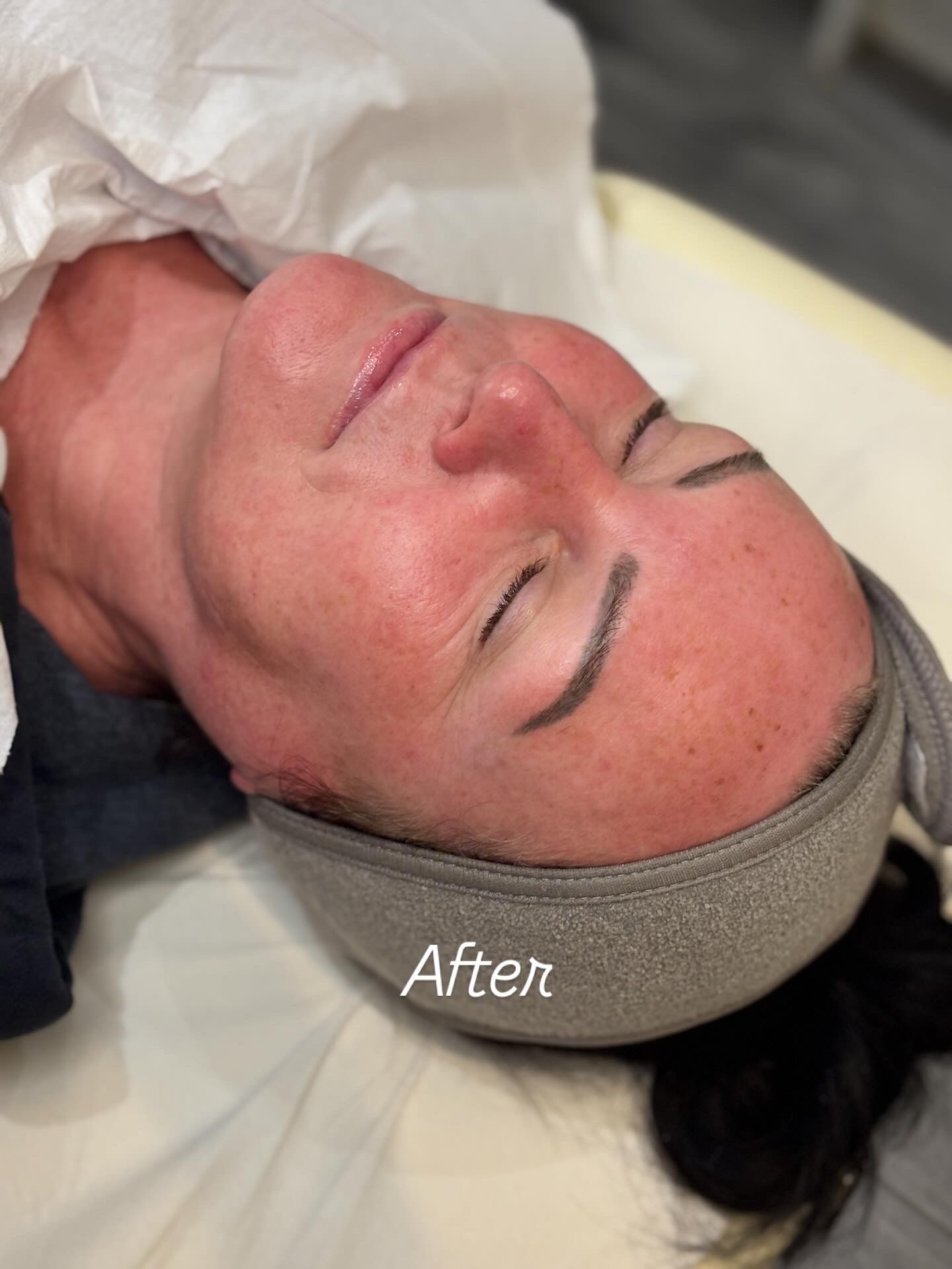 Advanced skin treatments