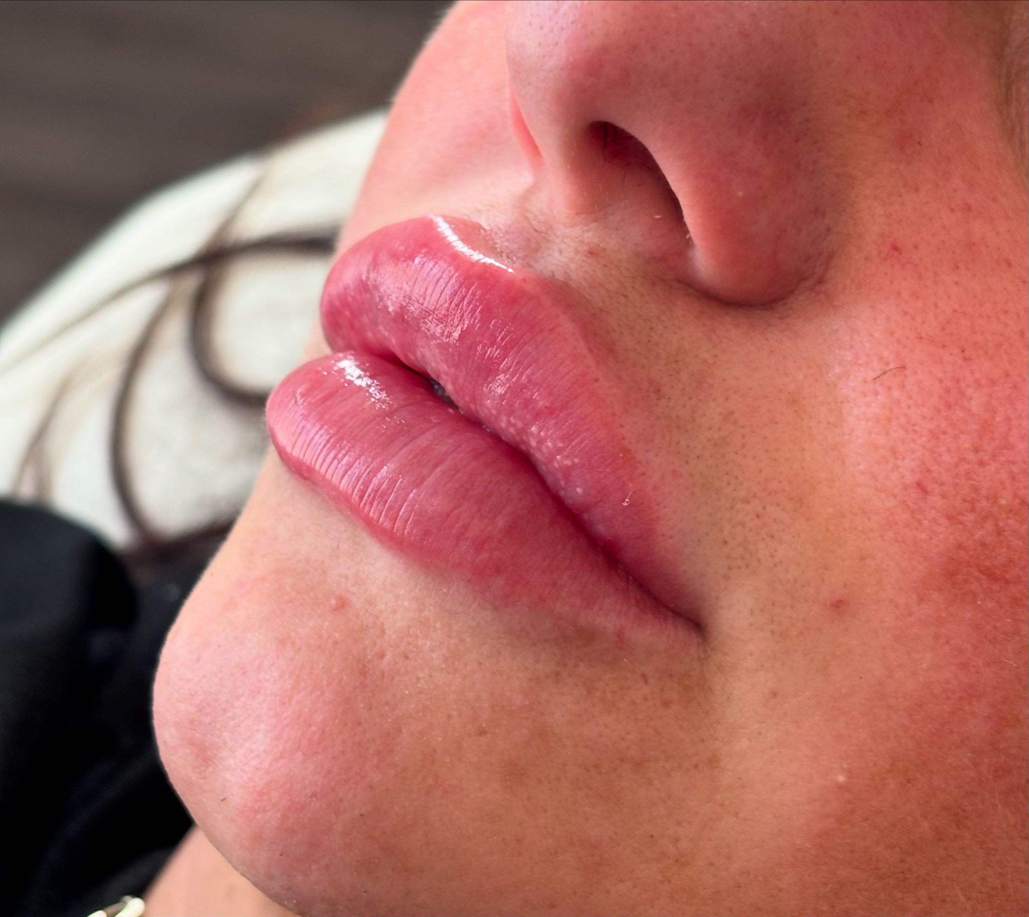 free aesthetic consultation