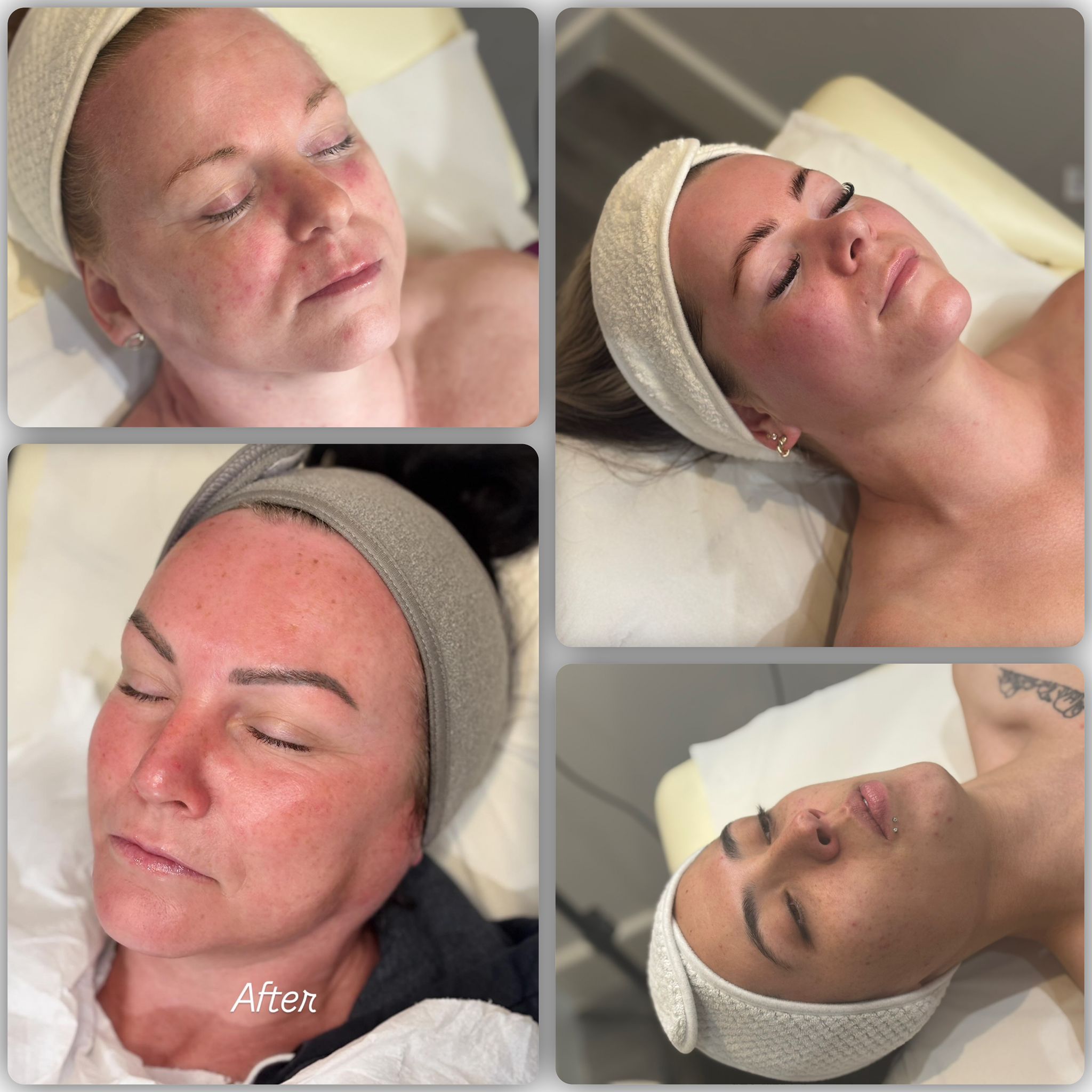 advanced skin treatments