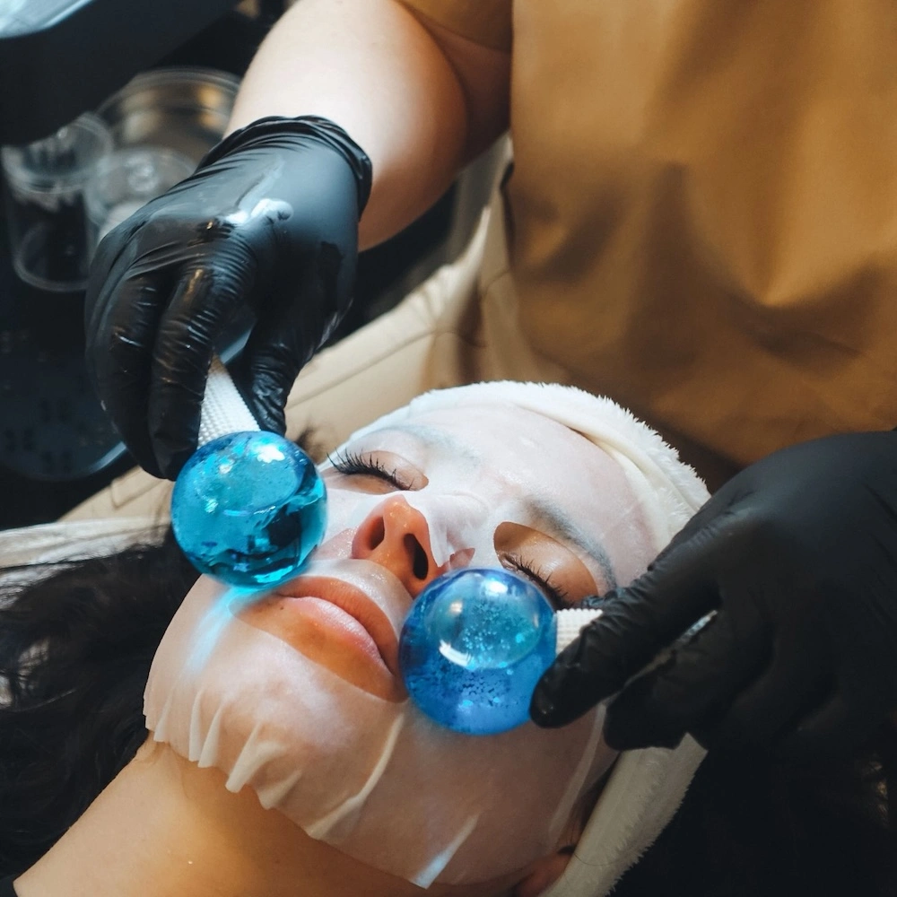 Chemical peel