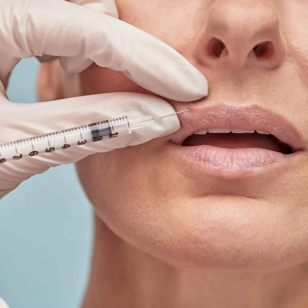 Lip flip treatment
