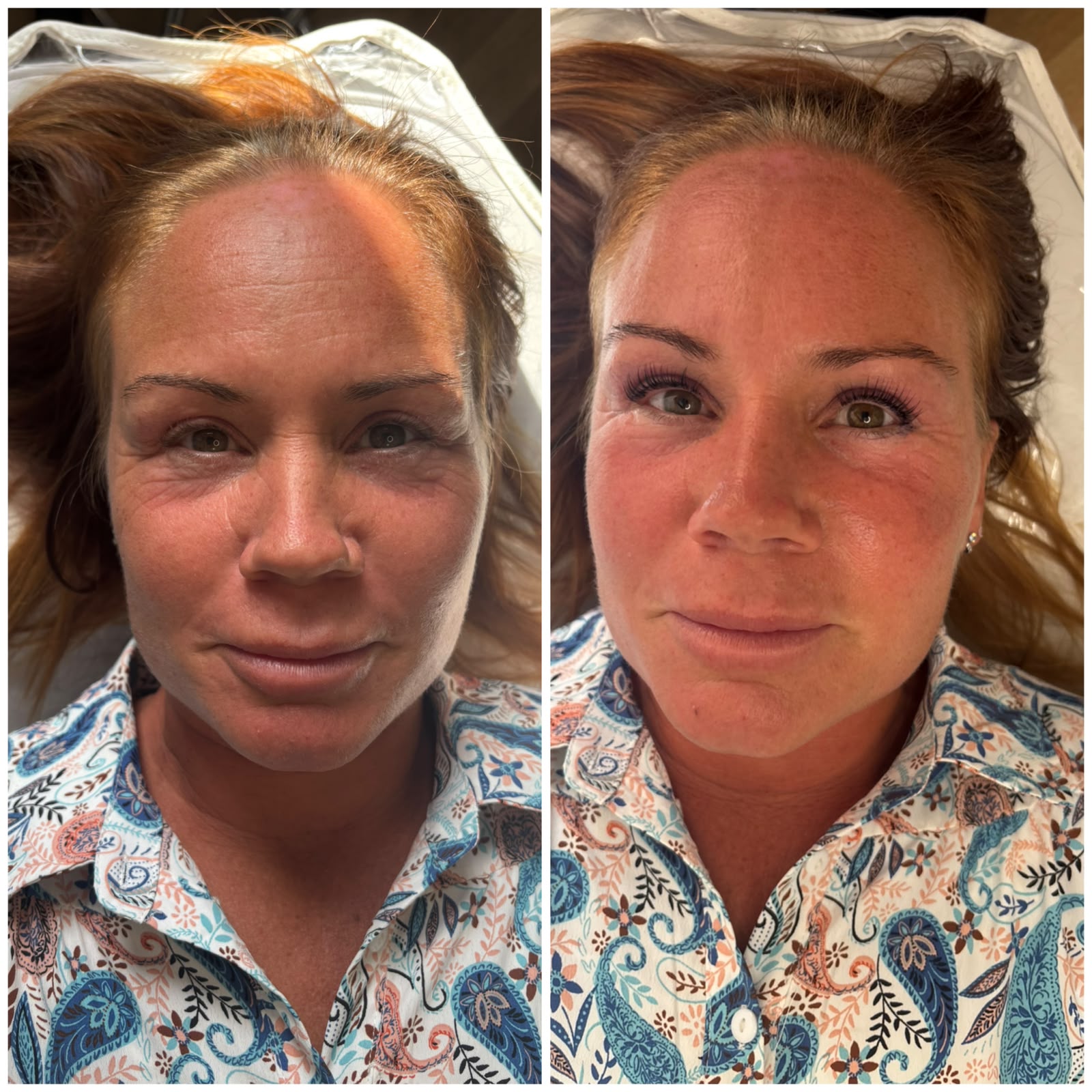 Korean lash lift