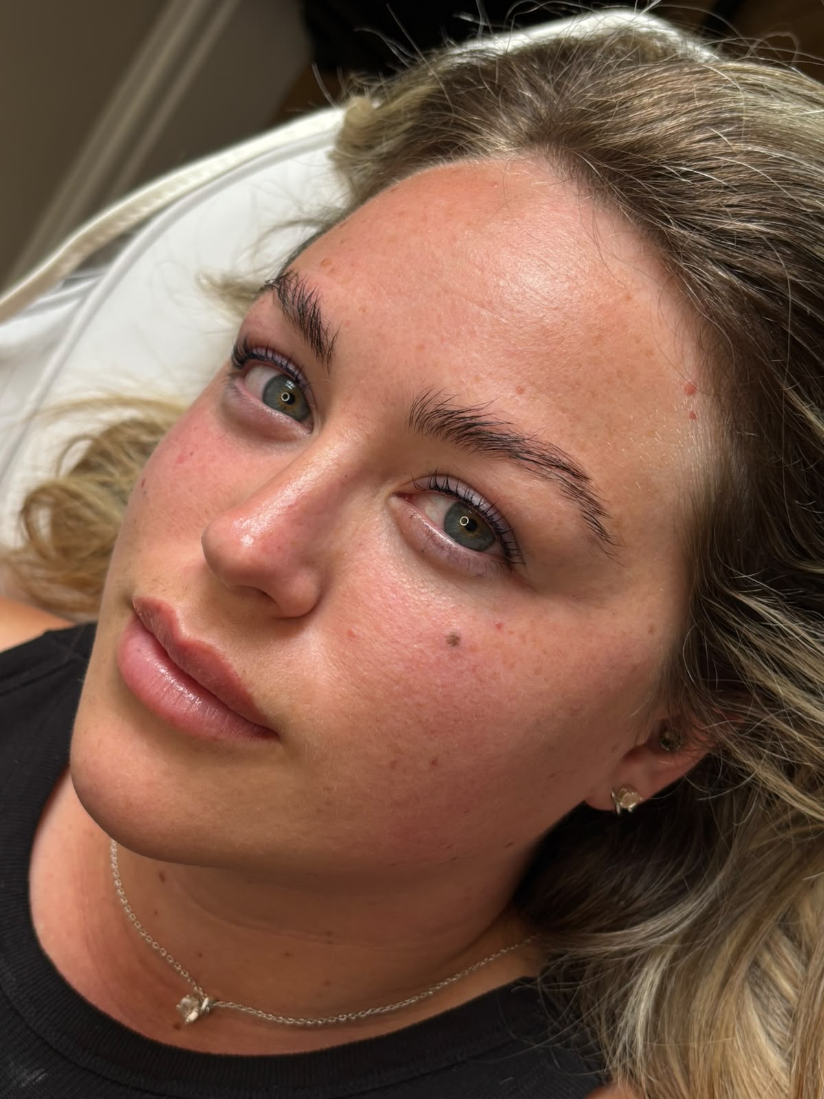 Beauty treatments