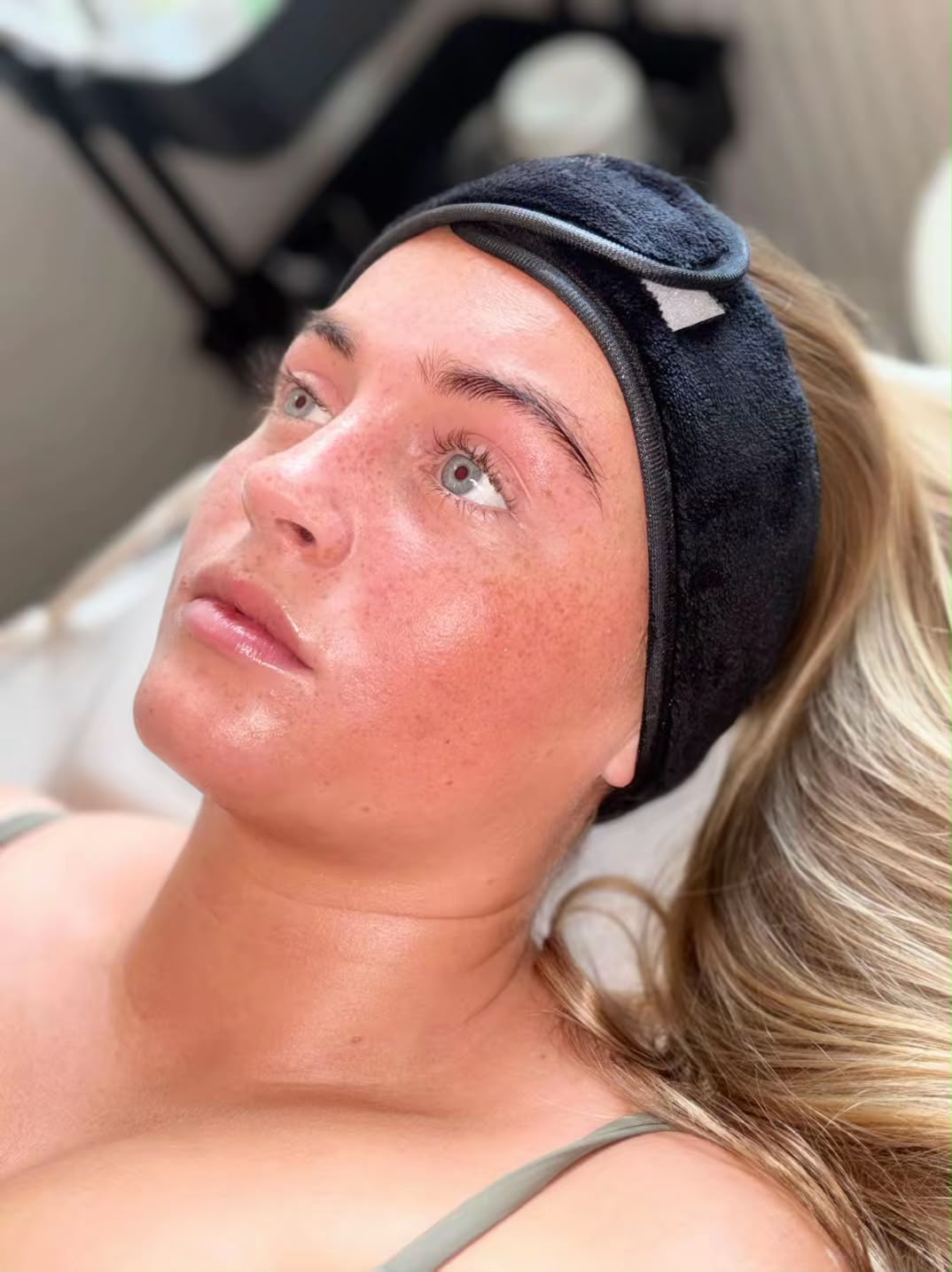 advanced skin treatments